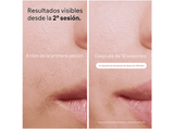 Depiladora IPL- Braun Luz Pulsada Silk-expert Pro 5 PL5052, Reducción Permanente Vello Visible, Skin Pro 2.0, 1 Cabezal estándar