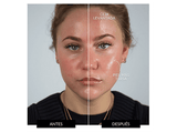 Rejuvenecedor facial - Ziip Halo ZP-HALO, Cara, Corrientes Eléctricas Personalizadas, Tecnología Dual Avanzada, Blanco