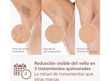 Depiladora IPL - Philips Lumea S9900 BRI951/01, Luz pulsada, Depilación permanente, Cara y cuerpo, 450.000 pulsos, Sensor SmartSkin, Skin AI