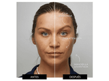 Rejuvenecedor facial - Ziip Halo ZP-HALO, Cara, Corrientes Eléctricas Personalizadas, Tecnología Dual Avanzada, Blanco